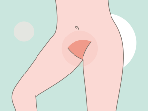 why is genital skin darker