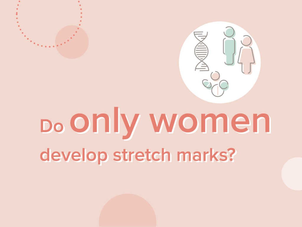 Deep stretch marks only experienced by women?