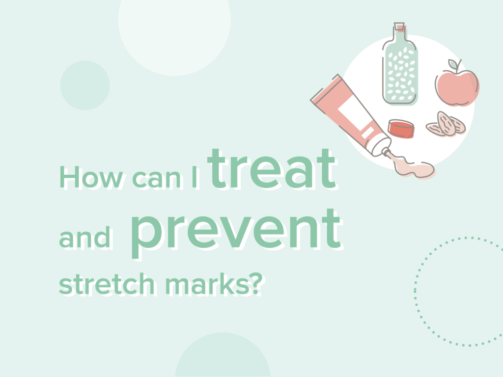 treating stretch marks
