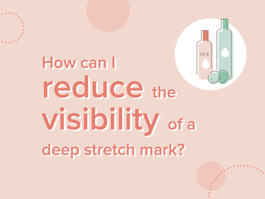 reduce visibility of stretch marks