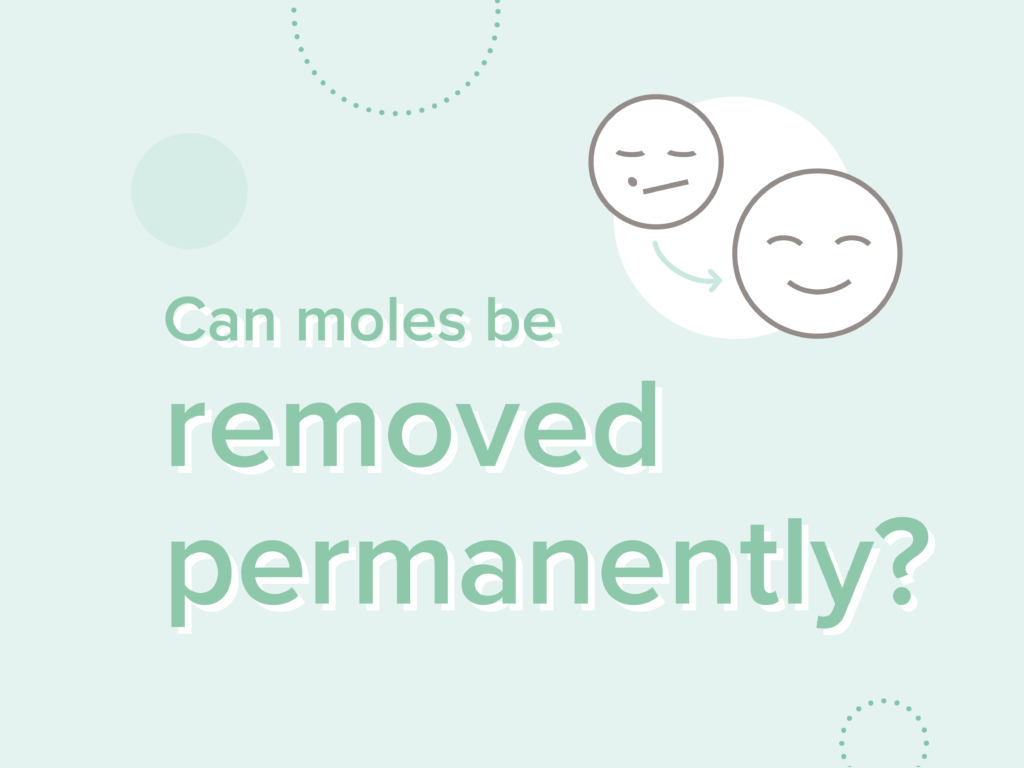 Can a mole be removed?