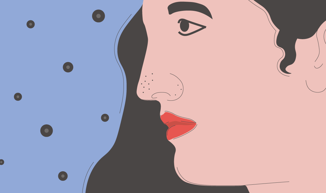 Close-up side profile illustration of a woman’s face showing visible blackheads on the nose and chin against a blue background with dark dots.