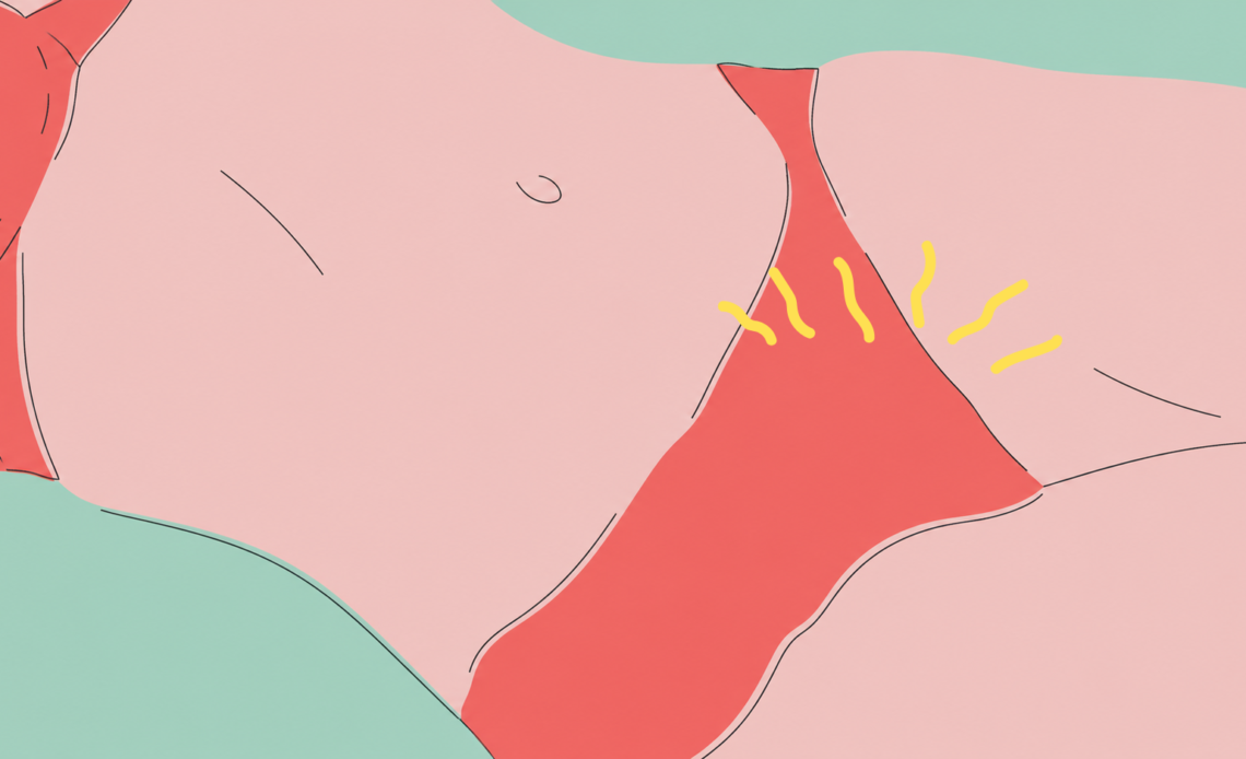 Close-up illustration of the pelvic area with yellow lines indicating irritation or discomfort around the vulva.